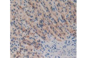 Used in DAB staining on fromalin fixed paraffin- embedded Kidney tissue (DOK7 抗体  (AA 63-320))