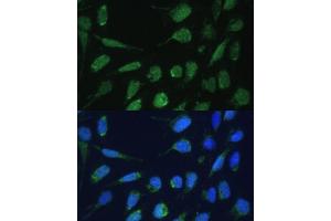Immunofluorescence (IF) image for anti-Dihydrolipoamide S-Succinyltransferase (E2 Component of 2-Oxo-Glutarate Complex) (DLST) (AA 1-290) antibody (ABIN6139665)