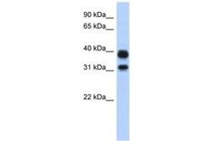 Image no. 1 for anti-Chitinase, Acidic (CHIA) (N-Term) antibody (ABIN6743114) (CHIA 抗体  (N-Term))