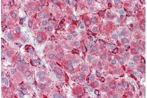 Human Adrenal (formalin-fixed, paraffin-embedded) stained with SERPINH1 antibody ABIN462363 followed by biotinylated anti-mouse IgG secondary antibody ABIN481714, alkaline phosphatase-streptavidin and chromogen. (SERPINH1 抗体)