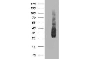 Western Blotting (WB) image for anti-ATG3 Autophagy Related 3 (ATG3) antibody (ABIN1496761) (ATG3 抗体)