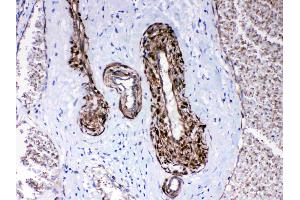 Immunohistochemistry (IHC) image for anti-Protein Phosphatase 1, Regulatory (Inhibitor) Subunit 14A (PPP1R14A) (AA 30-126) antibody (ABIN5518865)