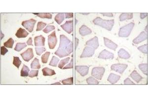 Immunohistochemistry analysis of paraffin-embedded human skeletal muscle tissue, using TNNI3 (Ab-22/23) Antibody. (TNNI3 抗体  (AA 5-54))