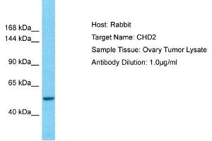 Host: Rabbit Target Name: CHD2 Sample Type: Ovary tumor lysates Antibody Dilution: 1. (CHD2 抗体  (N-Term))