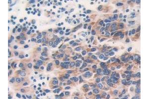 Immunohistochemistry (IHC) image for anti-Electron-Transfer-Flavoprotein, beta Polypeptide (ETFB) (AA 2-255) antibody (ABIN7440638)