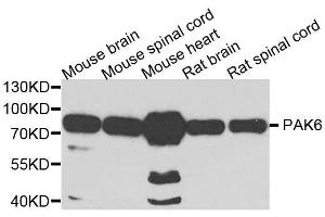 Western blot analysis of extracts of various cell lines, using PAK6 antibody. (PAK6 抗体  (AA 1-270))