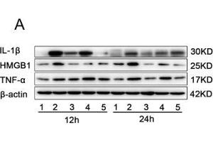 The effects of miR-339-5p and paeonol on LPS-induced RAW264. (IL-1 beta 抗体  (AA 1-269))