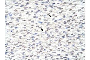 GRHL3 antibody was used for immunohistochemistry at a concentration of 4-8 ug/ml to stain Myocardial cells (arrows) in Human Heart. (GRHL3 抗体  (C-Term))
