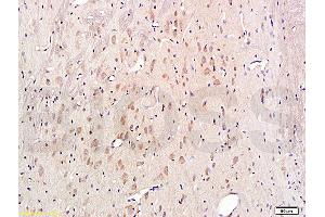 Formalin-fixed and paraffin embedded rat brain labeled with Rabbit Anti-Cytochrome C Polyclonal Antibody, Unconjugated (ABIN723590) 1:300 followed by conjugation to the secondary antibody and DAB staining (Cytochrome C 抗体  (AA 51-105))