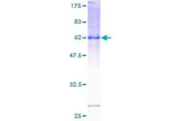 SGCD Protein (AA 1-290) (GST tag)