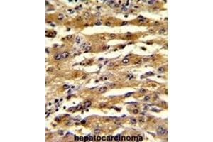 Immunohistochemistry (IHC) image for anti-Fatty Acid Binding Protein 3, Muscle and Heart (FABP3) antibody (ABIN3002667)