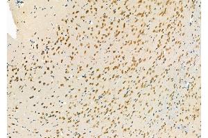 ABIN6264064 and ABIN6277250 at 1/100 staining Rat brain tissue by IHC-P. (PCBP2 抗体  (Internal Region))
