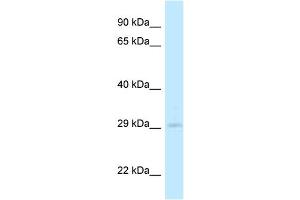 WB Suggested Anti-4933408B17Rik Antibody Titration: 1. (4933408B17Rik 抗体  (C-Term))