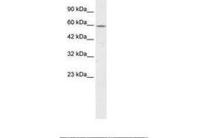 Image no. 1 for anti-Chaperonin Containing TCP1, Subunit 4 (Delta) (CCT4) (AA 453-502) antibody (ABIN6735873) (CCT4 抗体  (AA 453-502))