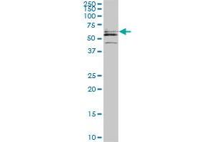 Western Blotting (WB) image for anti-Cytidine and DCMP Deaminase Domain Containing 1 (CDADC1) (AA 423-515) antibody (ABIN466247) (CDADC1 抗体  (AA 423-515))