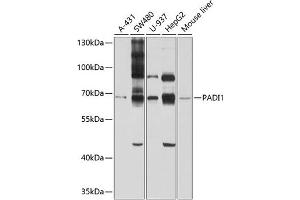 Western blot analysis of extracts of various cell lines, using P antibody (ABIN6128528, ABIN6145161, ABIN6145162 and ABIN6214293) at 1:1000 dilution. (PADI1 抗体  (AA 1-260))