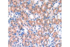 Used in DAB staining on fromalin fixed paraffin- embedded Kidney tissue (UBAP1 抗体  (AA 1-224))