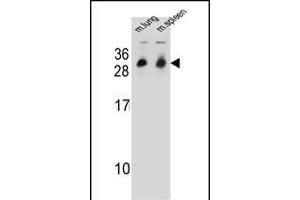 CYB561D1 Antibody (C-term) (ABIN654999 and ABIN2844633) western blot analysis in mouse lung,spleen tissue lysates (35 μg/lane). (CYB561D1 抗体  (C-Term))