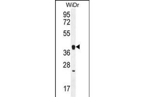 OR2T8 Antibody (C-term) (ABIN656071 and ABIN2845419) western blot analysis in WiDr cell line lysates (35 μg/lane). (OR2T8 抗体  (C-Term))