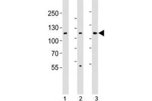 Western blot analysis of lysate from 1) HT-29, 2) HeLa, and 3) Jurkat cell line using JAK1 antibody; Ab was diluted at 1:1000. (JAK1 抗体  (N-Term))