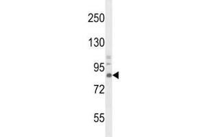 Western Blotting (WB) image for anti-Neurotrophic Tyrosine Kinase, Receptor, Type 1 (NTRK1) antibody (ABIN3031990)