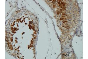 Immunoperoxidase of monoclonal antibody to AKT1 on formalin-fixed paraffin-embedded human testis. (AKT1 抗体  (AA 1-480))