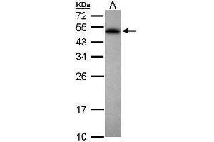 WB Image Sample (30 ug of whole cell lysate) A: Jurkat 12% SDS PAGE antibody diluted at 1:1000 (PABPN1 抗体)