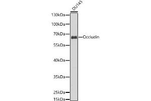 Western blot analysis of extracts of DU145 cells, using Occludin antibody (ABIN6129067, ABIN6144995, ABIN6144997 and ABIN6216324) at 1:1000 dilution. (Occludin 抗体  (AA 350-450))