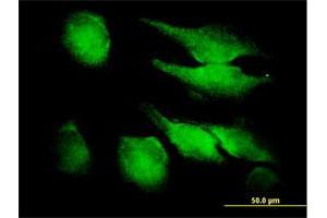 Immunofluorescence of purified MaxPab antibody to FGF1 on HeLa cell. (FGF1 抗体  (AA 1-155))