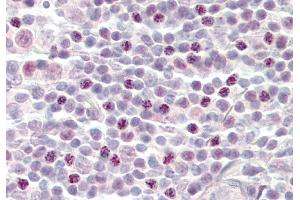 Rabbit Anti-SF3B3 antibody  Formalin Fixed Paraffin Embedded Tissue: Human Tonsil Primary antibody Concentration: 1:100 Secondary Antibody: Donkey anti-Rabbit-Cy3 Secondary Antibody Concentration: 1:200 Magnification: 20x Exposure Time: 0.