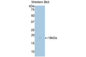 Detection of Recombinant dLK1, Human using Polyclonal Antibody to Delta Like 1 Homolog (dLK1) (DLK1 抗体  (AA 177-326))