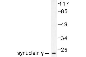Image no. 1 for anti-Synuclein, gamma (Breast Cancer-Specific Protein 1) (SNCG) antibody (ABIN271916) (SNCG 抗体)