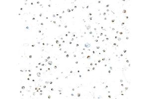 Immunocytochemistry (ICC) image for anti-Runt-Related Transcription Factor 2 (RUNX2) (AA 300-350) antibody (ABIN7795797) (Recombinant RUNX2 抗体  (AA 300-350))