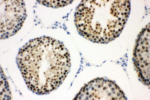IHC analysis of CCNE1 using anti-CCNE1 antibody (ABIN7601193).
