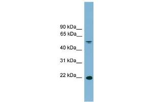 Human Spleen; WB Suggested Anti-HDGFRP3 Antibody Titration: 0. (HDGFRP3 抗体  (Middle Region))