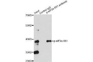 Immunoprecipitation analysis of 200ug extracts of HeLa cells treated by CA using 2. (EIF2S1 抗体  (pSer51))