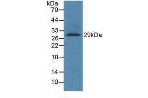 Western blot analysis of recombinant Human TLR8. (TLR8 抗体  (AA 844-1039))