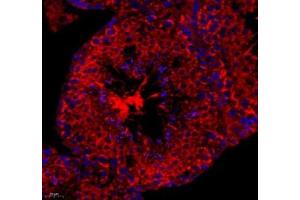 Immunofluorescence of paraffin embedded mouse spleen using cfap58 (ABIN7073535) at dilution of 1: 650 (400x lens) (CCDC147 抗体)