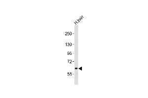 Anti-NOTCH4 Antibody (C-term)at 1:2000 dilution + human liver lysates Lysates/proteins at 20 μg per lane. (NOTCH4 抗体  (C-Term))