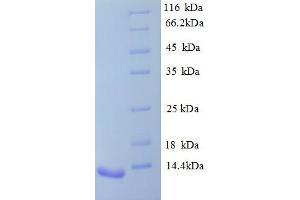 SDS-PAGE (SDS) image for Arginine Vasopressin Receptor 1B (AVPR1B) (AA 343-425), (partial) protein (His tag) (ABIN5712992) (AVPR1B Protein (AA 343-425, partial) (His tag))