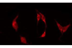 Immunofluorescence (fixed cells) (IF/ICC) image for anti-Egf-Like Module Containing, Mucin-Like, Hormone Receptor-Like 1 (EMR1) (C-Term) antibody (ABIN6258146)