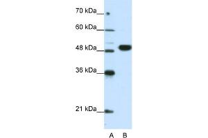 WB Suggested Anti-EIF4A2 Antibody Titration:  0. (EIF4A2 抗体  (N-Term))