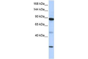 WB Suggested Anti-TDRD9 Antibody Titration: 0. (TDRD9 抗体  (Middle Region))