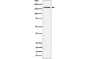 Western blot analysis of AGL expression in K562 cell lysate. (Recombinant AGL 抗体)