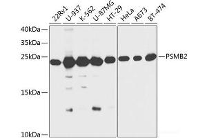 Western blot analysis of extracts of various cell lines using PSMB2 Polyclonal Antibody at dilution of 1:1000. (PSMB2 抗体)