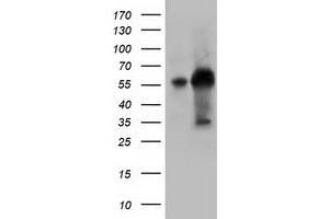 Western Blotting (WB) image for anti-Kelch-Like 2, Mayven (KLHL2) (AA 1-100), (AA 494-593) antibody (ABIN1490547) (KLHL2 抗体  (AA 1-100, AA 494-593))