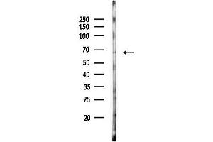 anti-Phosphatidylinositol Glycan T (PIGT) antibody