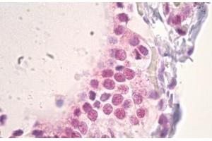 Anti-PARK2 antibody IHC staining of human thyroid.