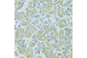 Immunohistochemistry of paraffin-embedded human stomach using TJP2 antibody (ABIN5970222) at dilution of 1/100 (40x lens). (TJP2 抗体)