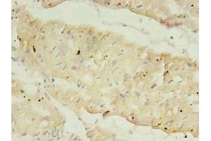 Immunohistochemistry (IHC) image for anti-ATPase, Ca++ Transporting, Cardiac Muscle, Slow Twitch 2 (ATP2A2) (AA 314-756) antibody (ABIN7168600)